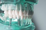 Действия при ненадлежащем качестве лечения в стоматологической клинике.